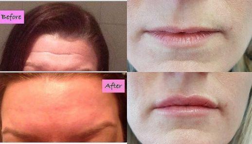 Aesthetics - Non-Surgical Facial Rejuvenation by Sue Hogg